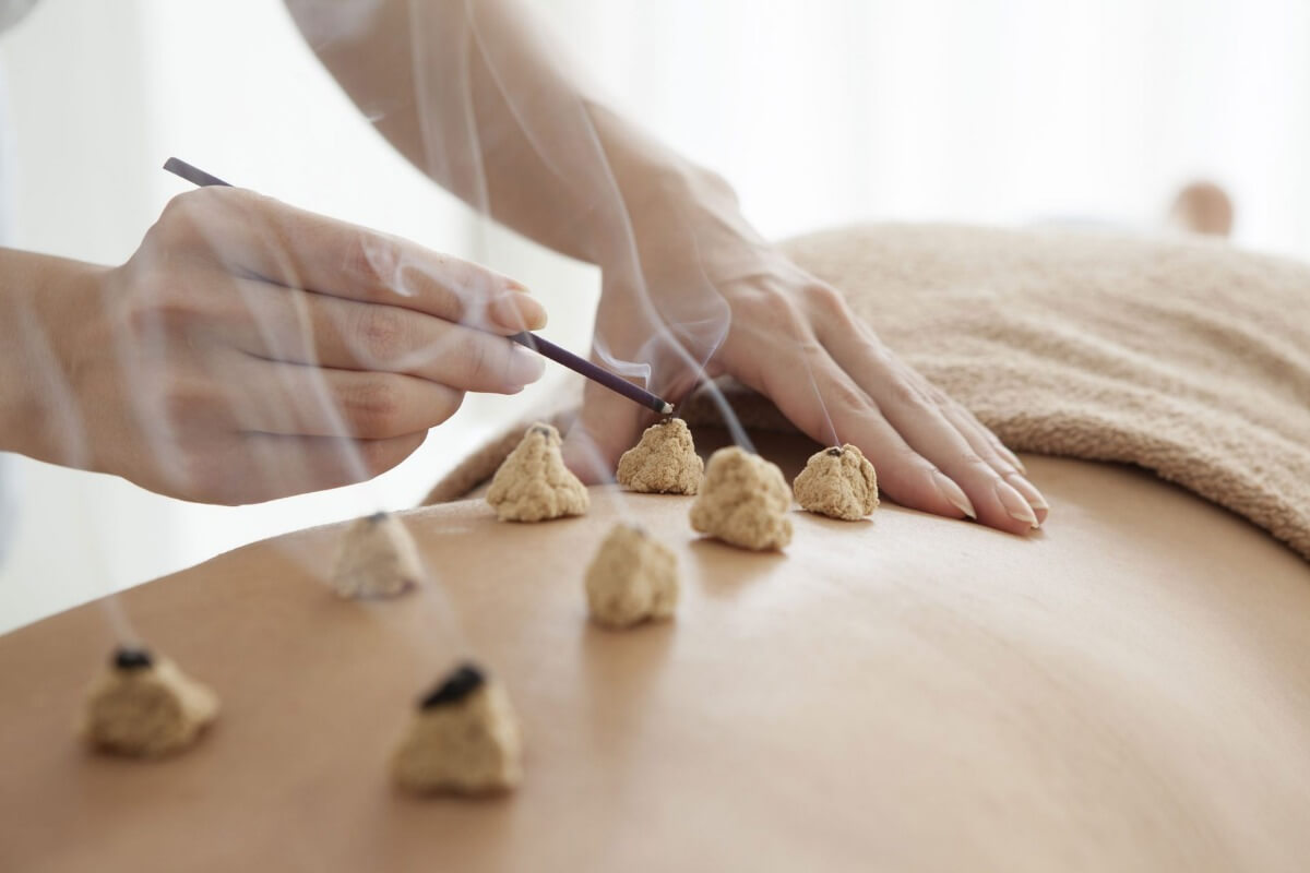 Moxibustion chinoise: alternative à l'acupuncture - Laboratoires Bimont