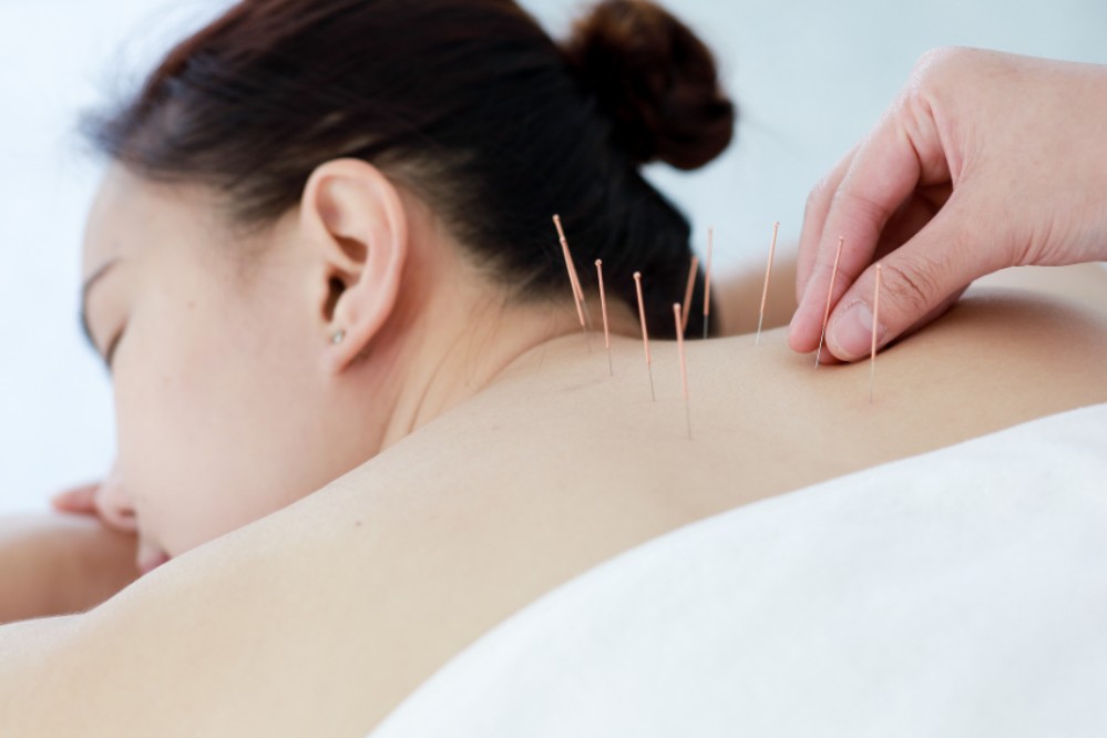 How-Many-Sessions-of-Acupuncture-Does-It-Take-To-See-Results