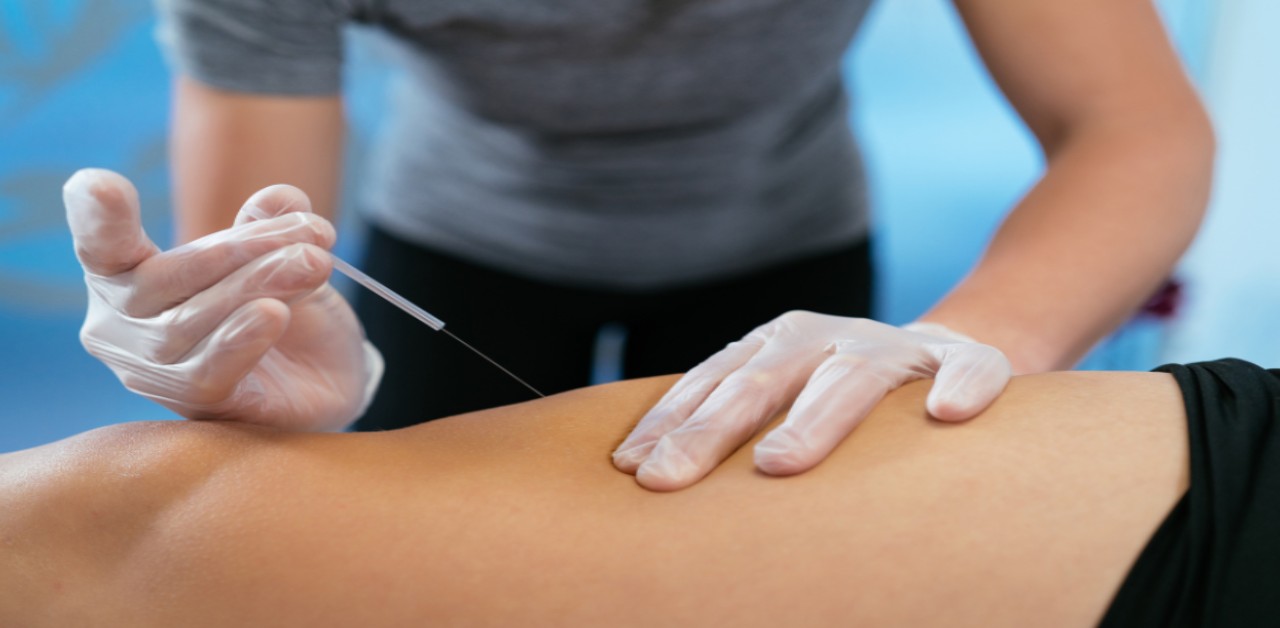 Exploring the 7 Different Types of Acupuncture Techniques American
