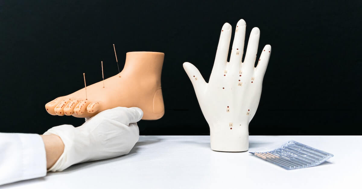 Benefits of Acupuncture for Neuropathy American Institute of