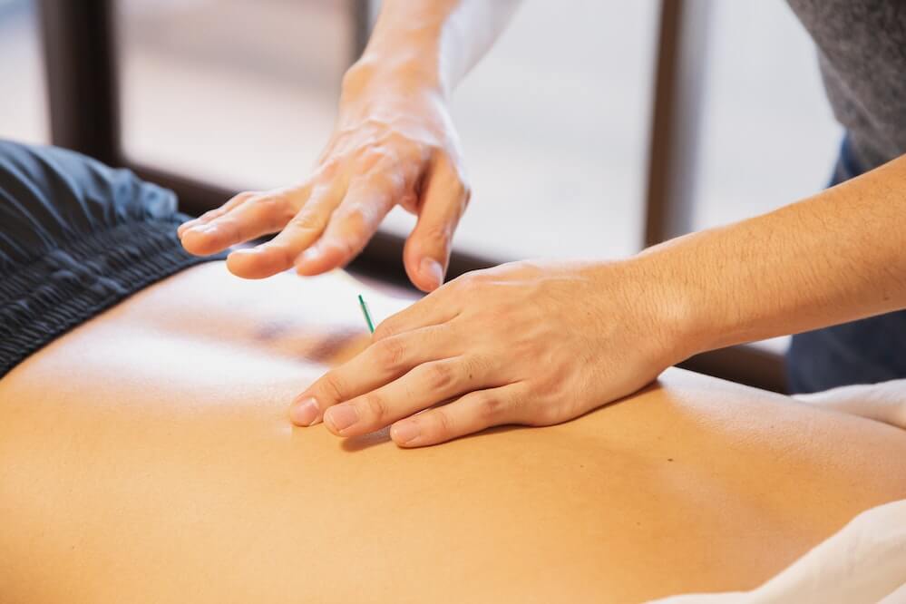 aIAM Acupuncture