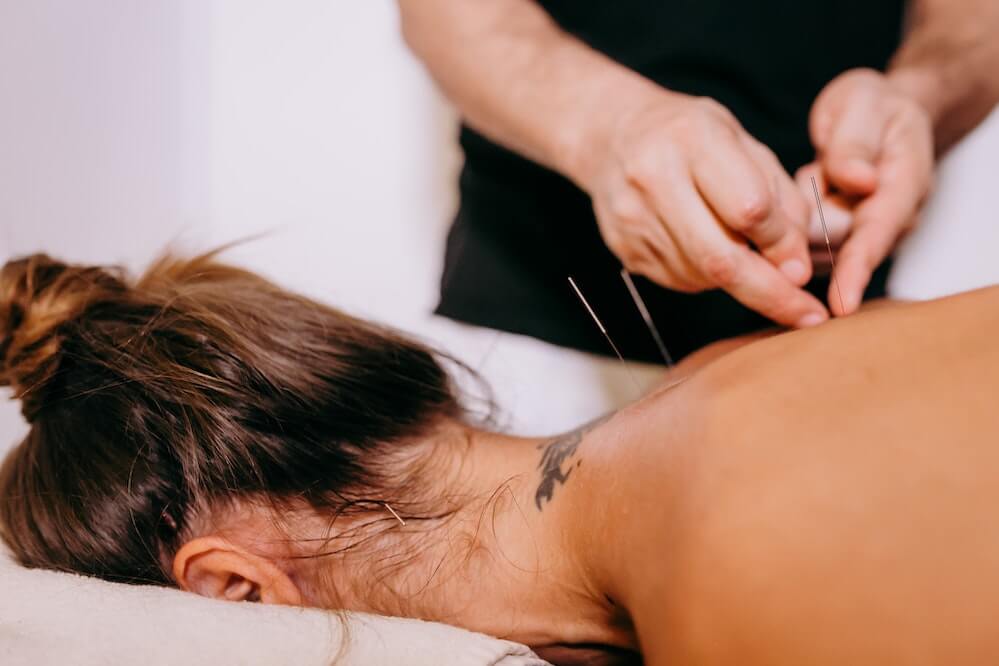 what-makes-a-good-acupuncturist-