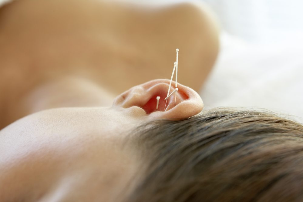 ear-acupuncture-procedure-and-techniques