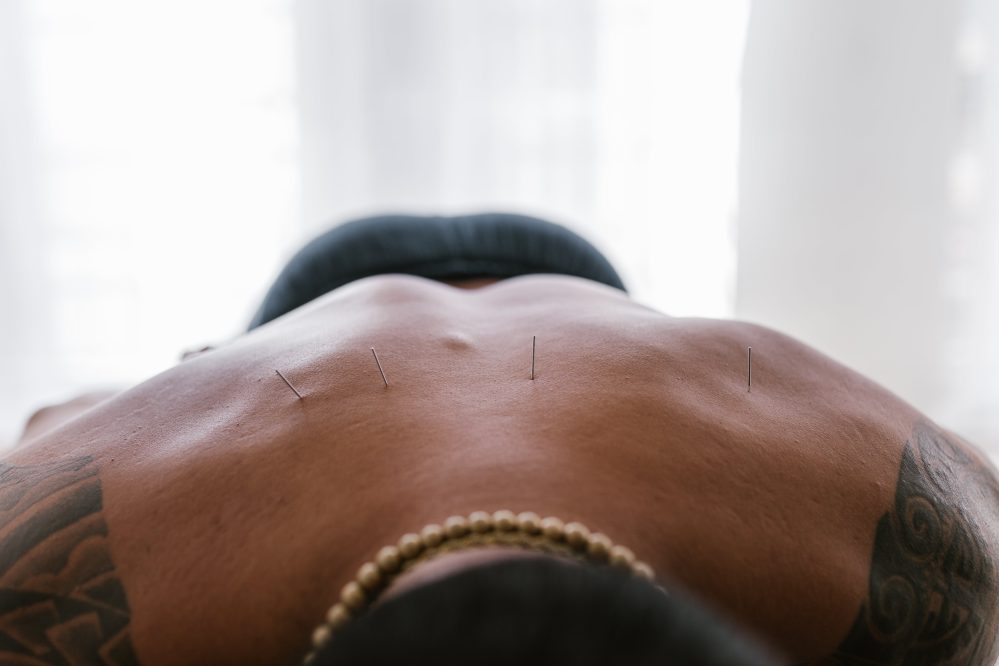 why-are-medians-important-in-acupuncture