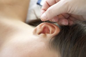 acupuncture-ear-points