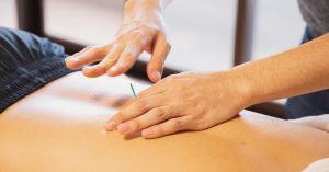 acupuncture-for-lower-back-pain