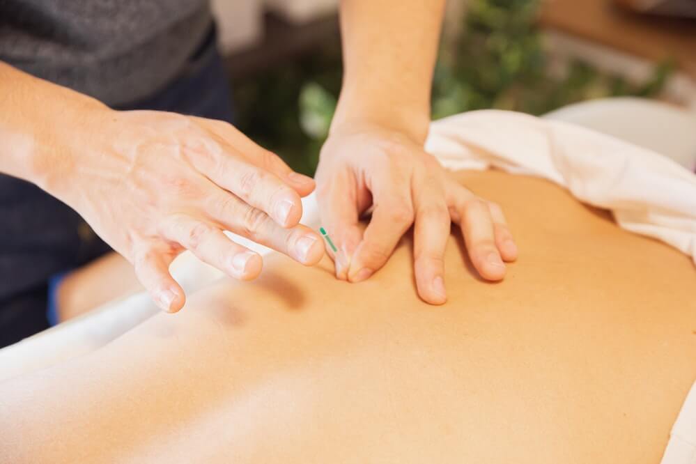 is-acupuncture-effective-for-lower-back-pain