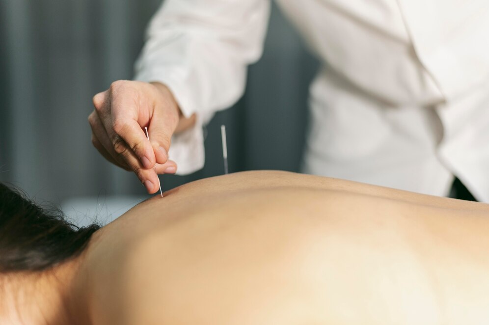 how-long-do-acupuncture-detox-symptoms-last