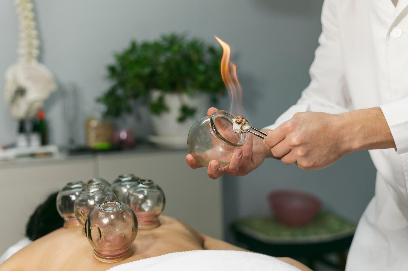 benefits-of-fire-cupping