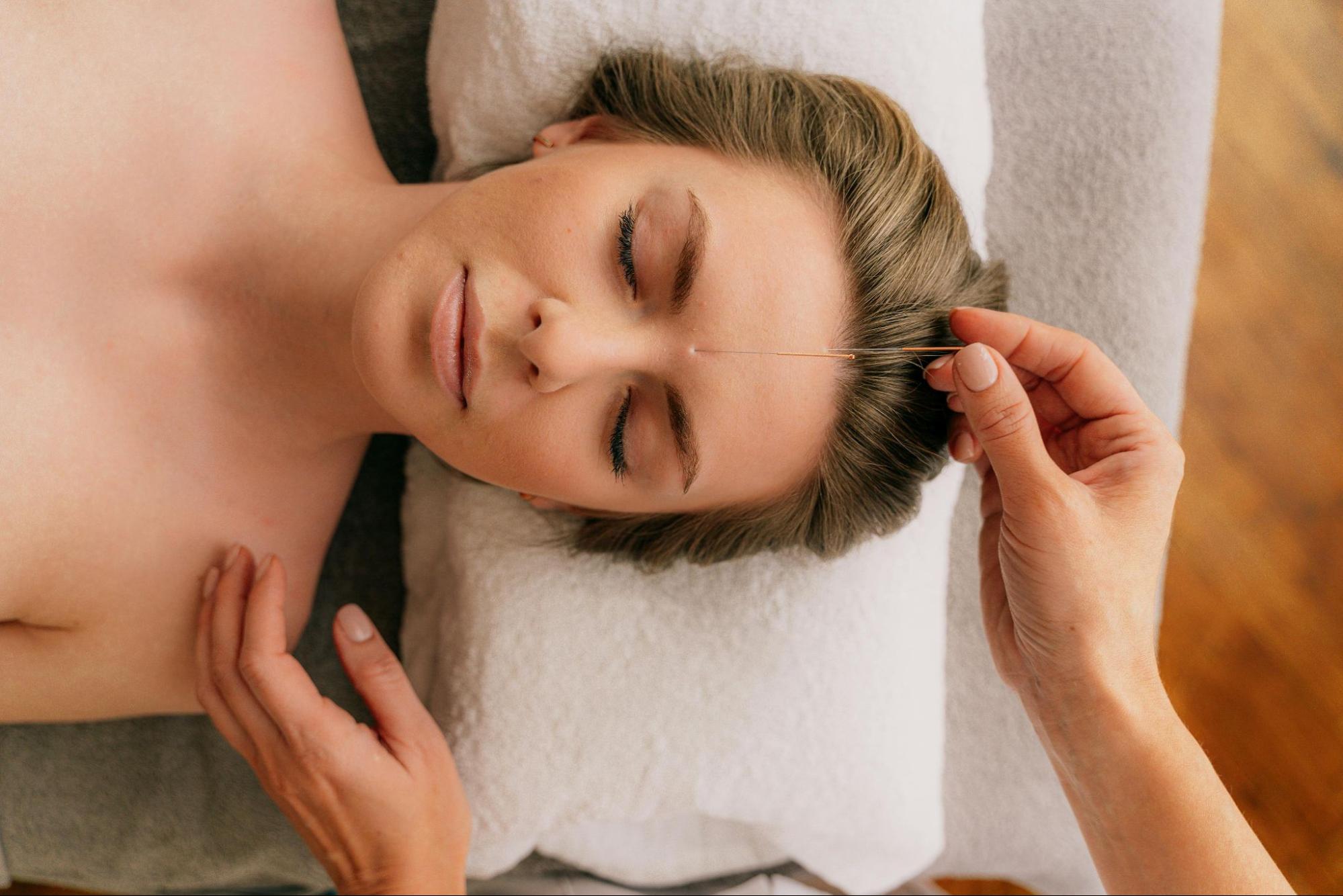 how-does-acupuncture-work