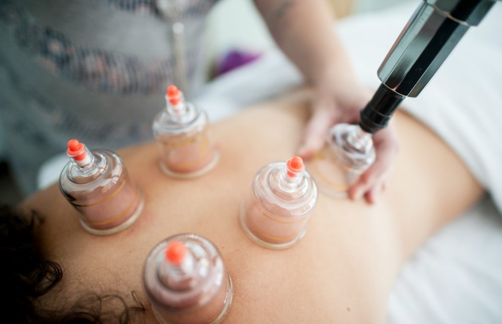 how-gliding-cupping-massage-works